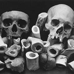    (Irving Penn)     (Bone Landscape)   (Still life)